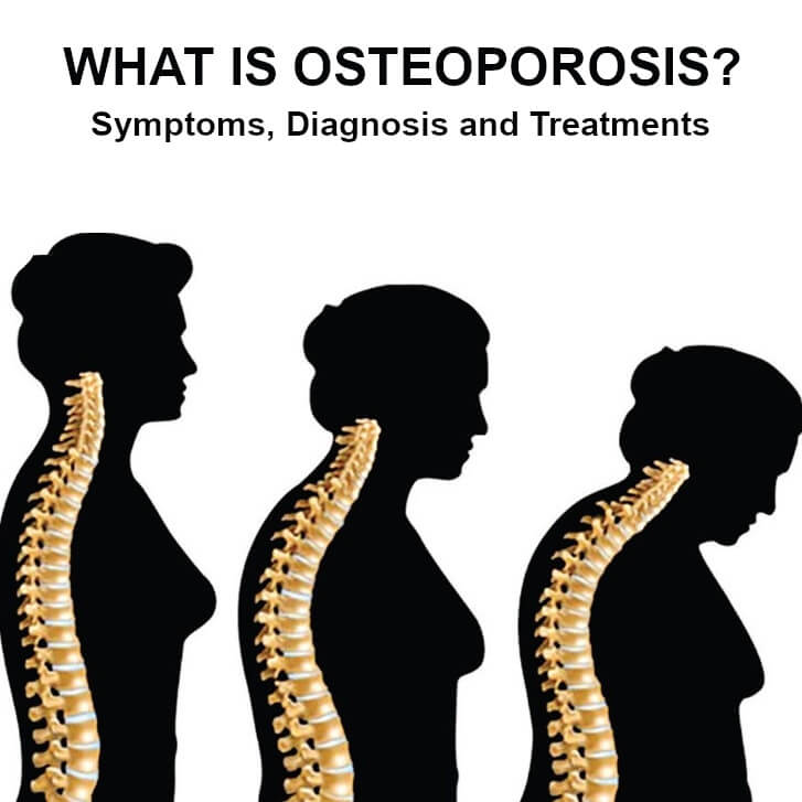 Read our article on Osteoporosis, it's symptoms, diagnosis and treatments.