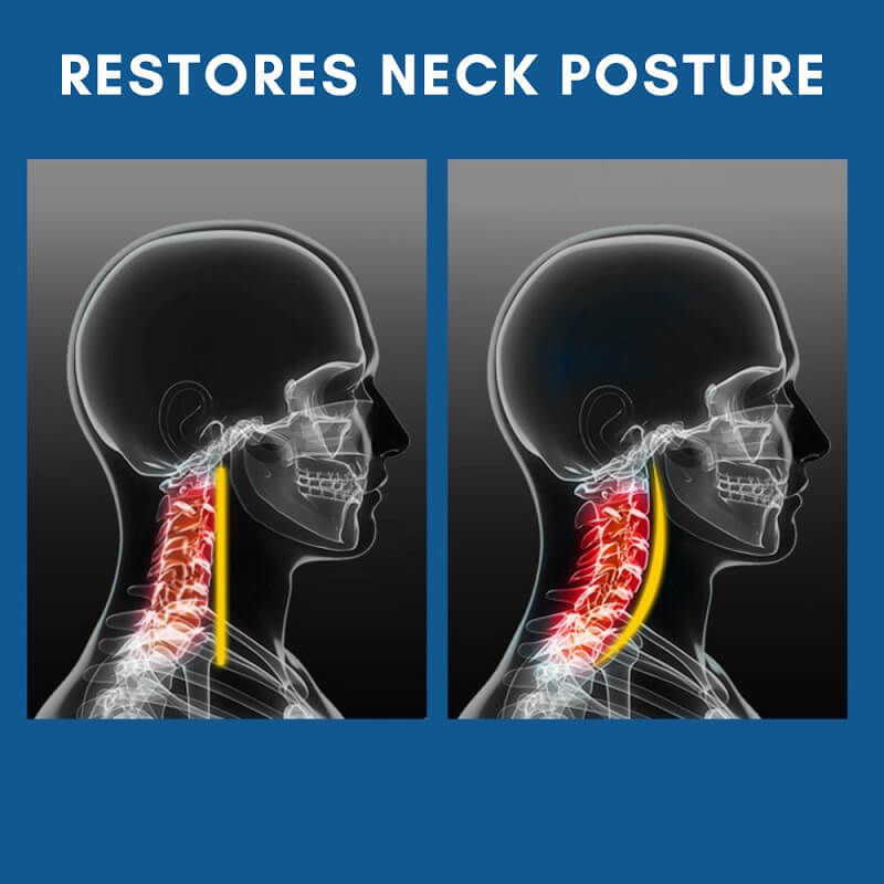 Image showing how the NeckEase neck brace can help restore poor neck posture.