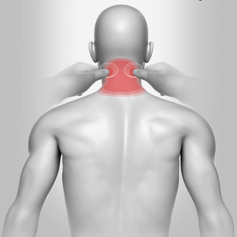 Graphic of sore areas of the neck.
